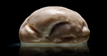 Weird brain has no ridges and folds