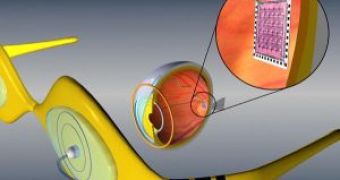 Pioneering Bionic Eye Implants