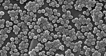 Scanning electron micrograph (SEM) image showing multiple groups of MRSA bacteria in an infected host