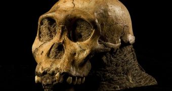 Researchers say early humans evolved to have robust faces to be able to take a beating