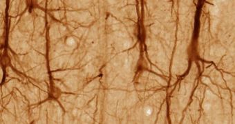Researchers figure out how to turn nerve cells damaged by Alzheimer's into induced pluripotent stem cells