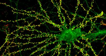 Low concentrations of several key regulatory proteins in synapses may be linked to the development of schizophrenia and ASD