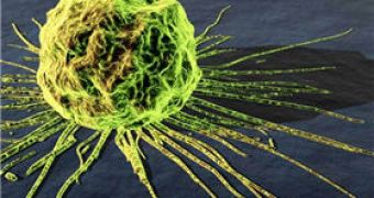 Protein Responsible for Cancer Identified