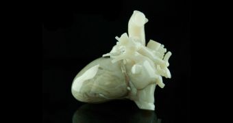 An example of 3D printed heart from Materialise
