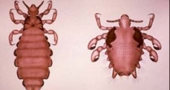 Pubic louse (Pthirus) (right) compared to head louse (Pediculus)