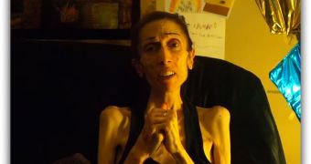 Rachel Farrokh, the Woman Dying from Anorexia, Has New Message for Her Supporters - Video