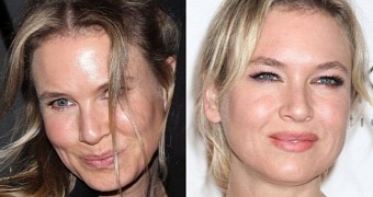 Renee Zellweger Got Plastic Surgery to Keep Getting Acting Roles