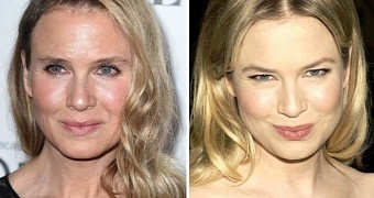 Renee Zellweger now and then: no plastic surgery, just happiness, she says