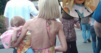Recent photo of Tori Spelling, ribcage visible from behind