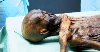Researchers Find New Tattoos on Ötzi the Iceman's Ribcage