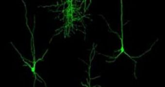 Restoring Plasticity to the Aged Brain