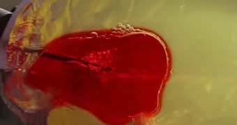 Blood clot being treated