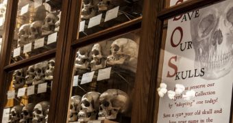 The collection of skulls is in need of restoration funds