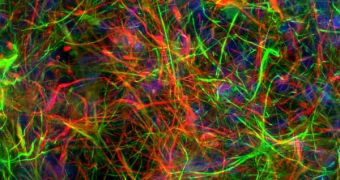 Glia cells in green, neurons in red inside brain tissue