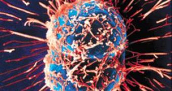 A dividing cancerous cell