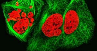 Lung-cancer cells often cause no symptoms in their early stages, which makes the disease that much more lethal