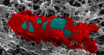 Septin proteins build cages (red) to trap bacteria (blue) that invade human cells