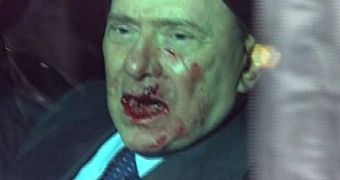 Silvio Berlusconi Attacked at Political Rally