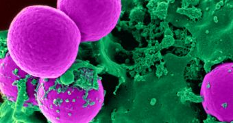 A MRSA colony in the human body. The bacteria is resistant to nearly all available antibiotics