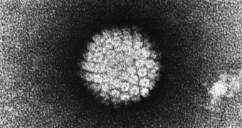 TEM image of HPV