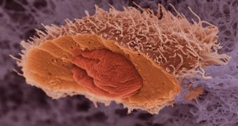 Colour-enhanced scanning electron micrography of a cancerous skin cell