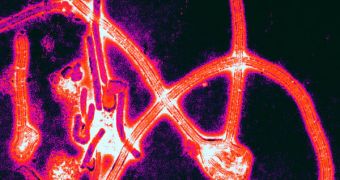 Color-enhanced electron micrograph of Ebola virus particles.