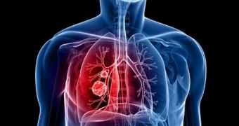 New breathalyzer test promises to make it easier to diagnose lung cancer