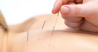 Swiss police arrest “healer” believed to have infected 16 people with HIV through acupuncture