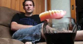 Young man's soda addiction costs him all his teeth