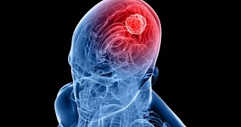 Study finds some tumors feed on people's thoughts