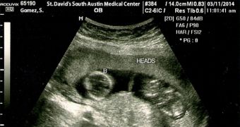 A sonogram with Selena's name on it indicates she's pregnant with Justin Bieber's twins