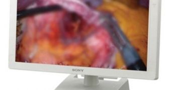 Sony releases OLED display for surgery use