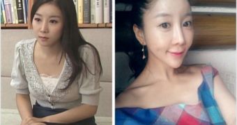 Photos of South Korean’s drastic transformation go viral, spark heated debate on what “beauty” is