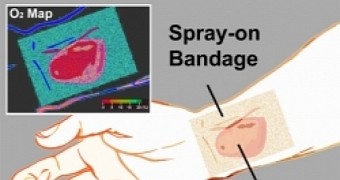 Spray-on smart bandage