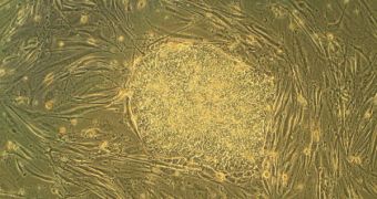 Human embryonic stem cells, growing in cell culture