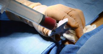 Stem Cell Revolution in Bone Marrow Transplant