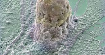 Human embryonic stem cell growing on a layer of supporting cells (fibroblasts)