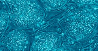 Stem cells of the dermis identified