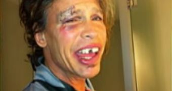 Steven Tyler after the fall in the shower