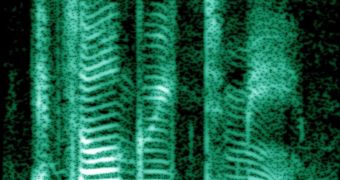 A spectrogram of a human voice