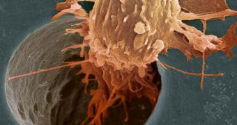 This image of a cancer cell moving down a pore in a filter was taken by Anne Weston of Cancer Research UK