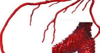 The left coronary arteries show the ramification of vessels and the red blood cells flowing in one sub-region. The longest coronary arteries have a size of a few centimeters and the red blood cells have a linear size of about 10 microns