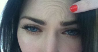 Megan Fox frowns to prove she hasn’t had Botox