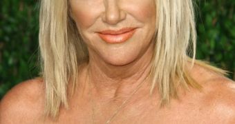 Suzanne Somers rants against Obamacare in op-ed, is mocked for the errors included in it