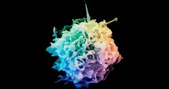 A colored scanning electron micrograph of a T cell