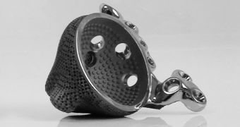 3D printed hip implant