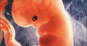 6-week-old human fetus