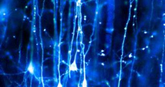 Neural connections can break apart and reappear without hindering the overall functioning of the brain
