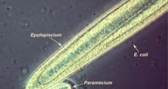 Comparison of Epulopiscium, Paramecium (a predatory protozoan) and E. coli, a small bacterium
