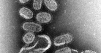 This negative stained transmission electron micrograph (TEM) shows recreated 1918 influenza virions that were collected from supernatants of 1918-infected Madin-Darby Canine Kidney (MDCK) cell cultures 18 hours after infection